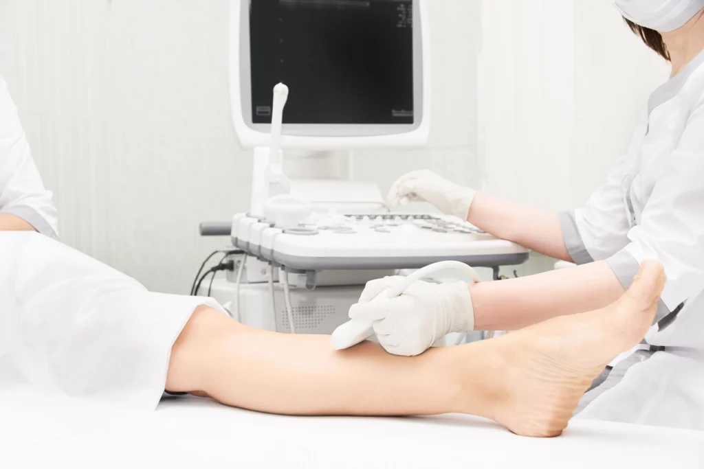 Vein treatment