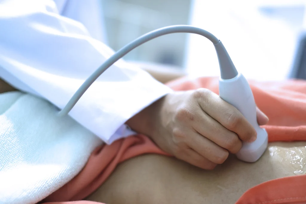 Echocardiogram Testing